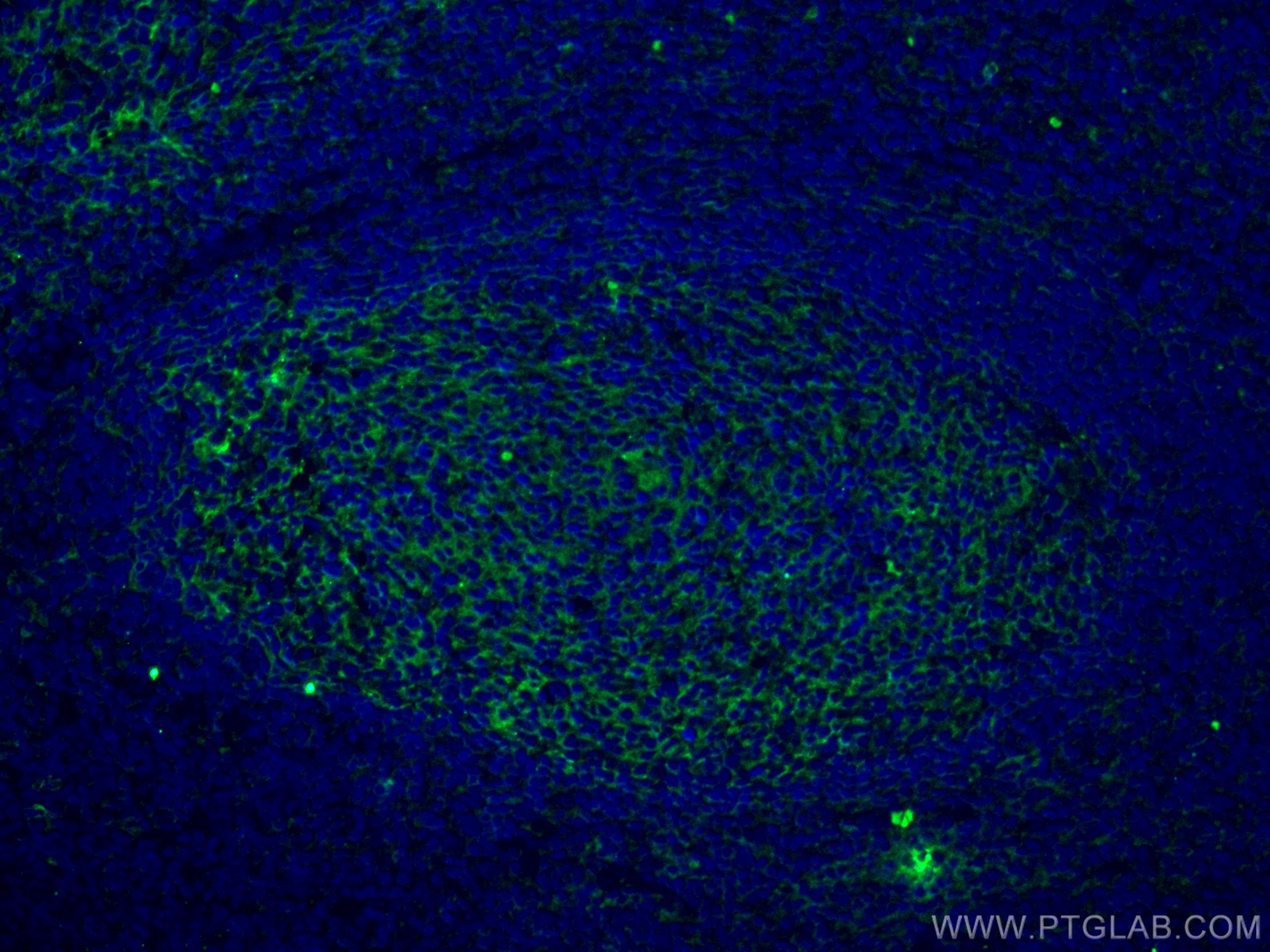 IF Staining of human tonsillitis using 66294-1-Ig