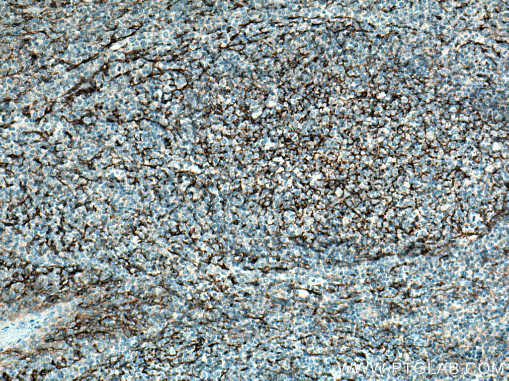 VCAM-1/CD106