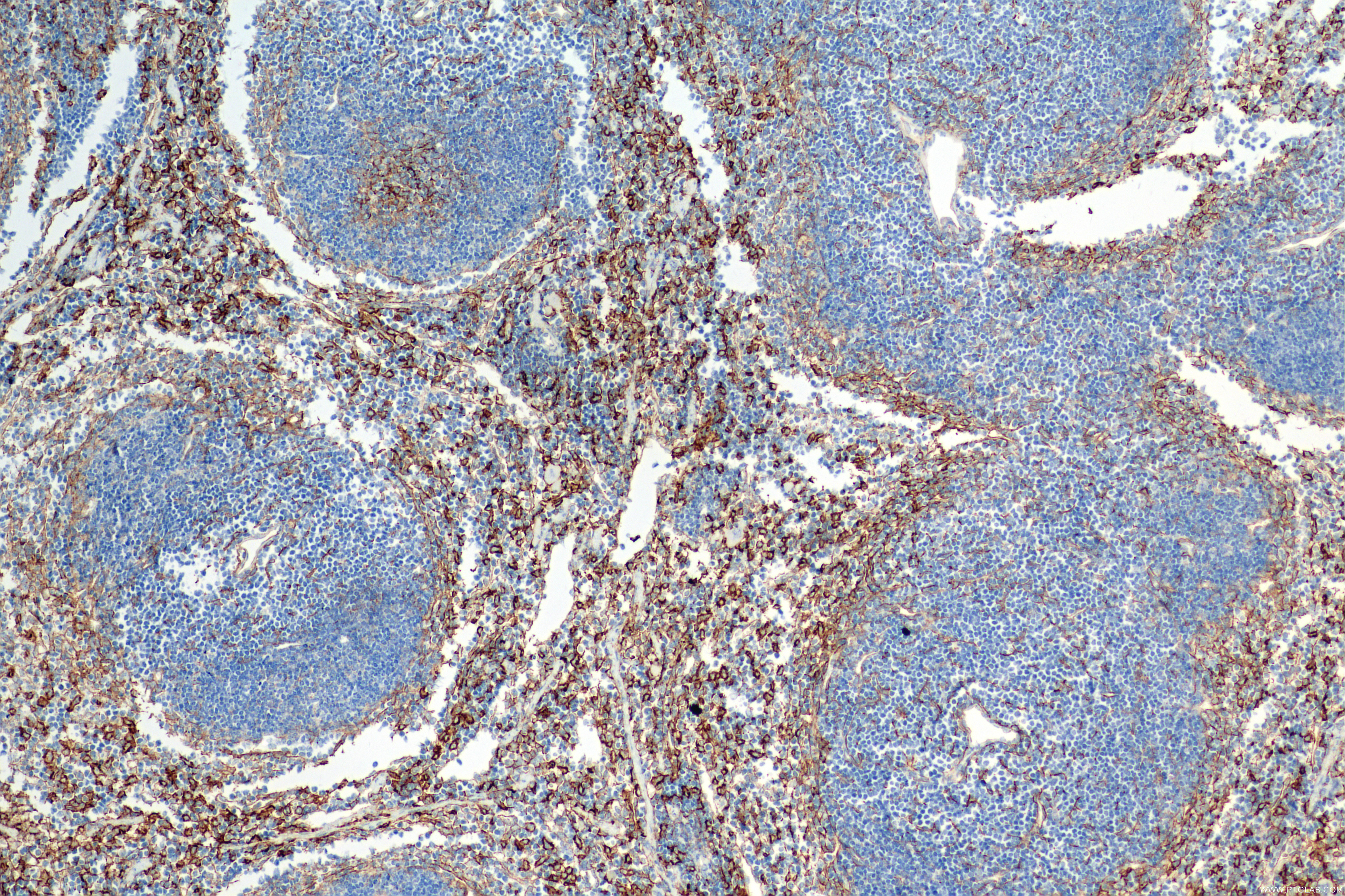 IHC staining of mouse spleen using 83719-1-RR (same clone as 83719-1-PBS)