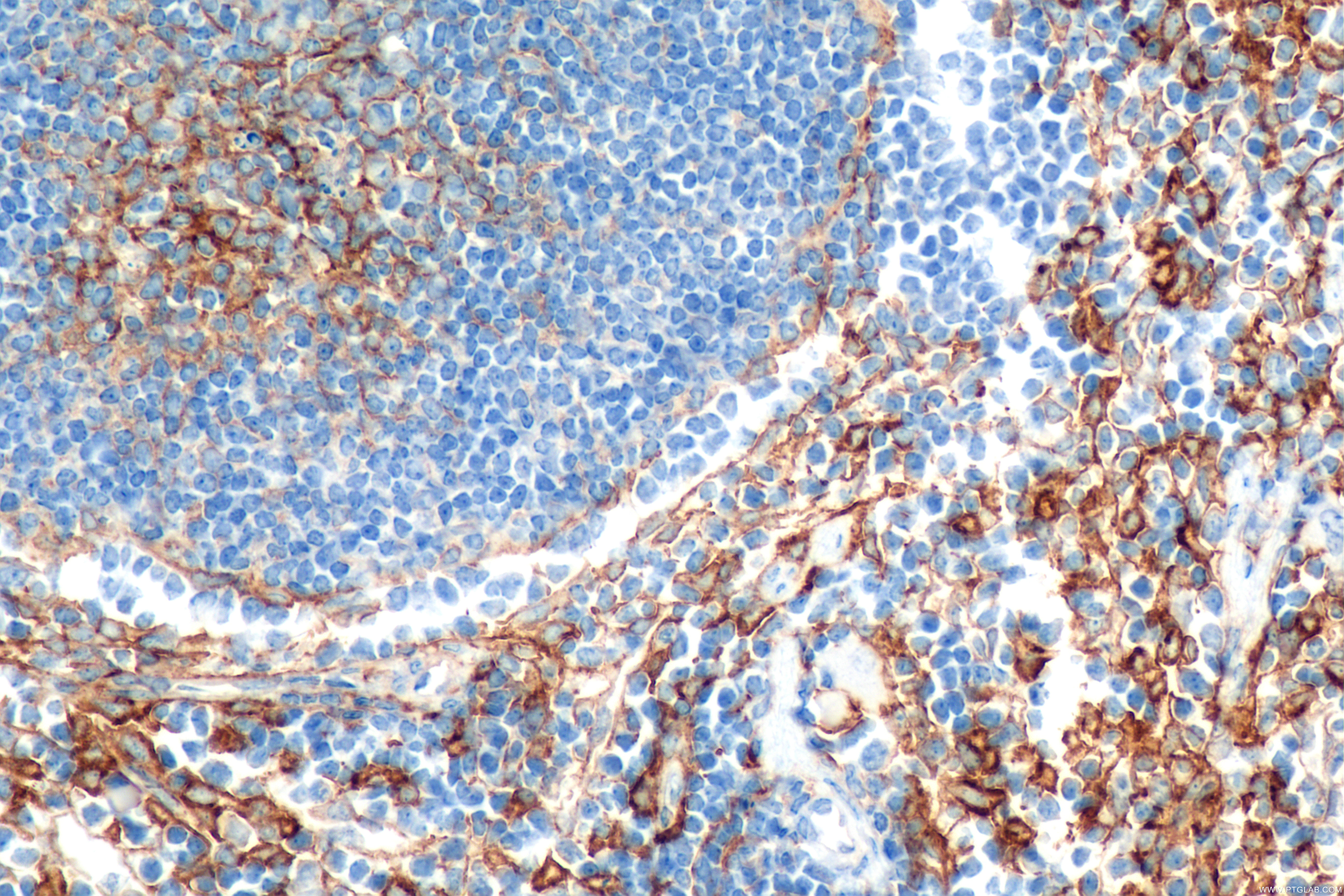 IHC staining of mouse spleen using 83719-1-RR (same clone as 83719-1-PBS)