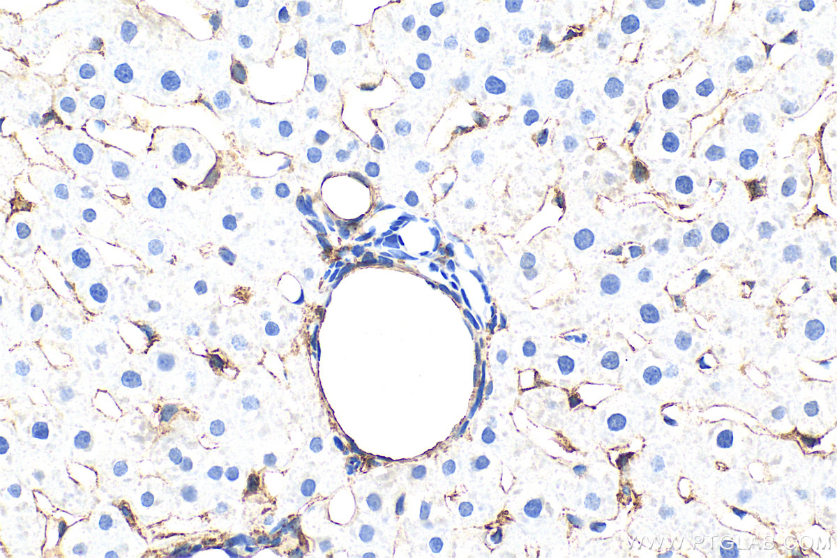 VCAM-1/CD106 antibody (33377-1-AP) | Proteintech | 武汉三鹰生物技术有限公司