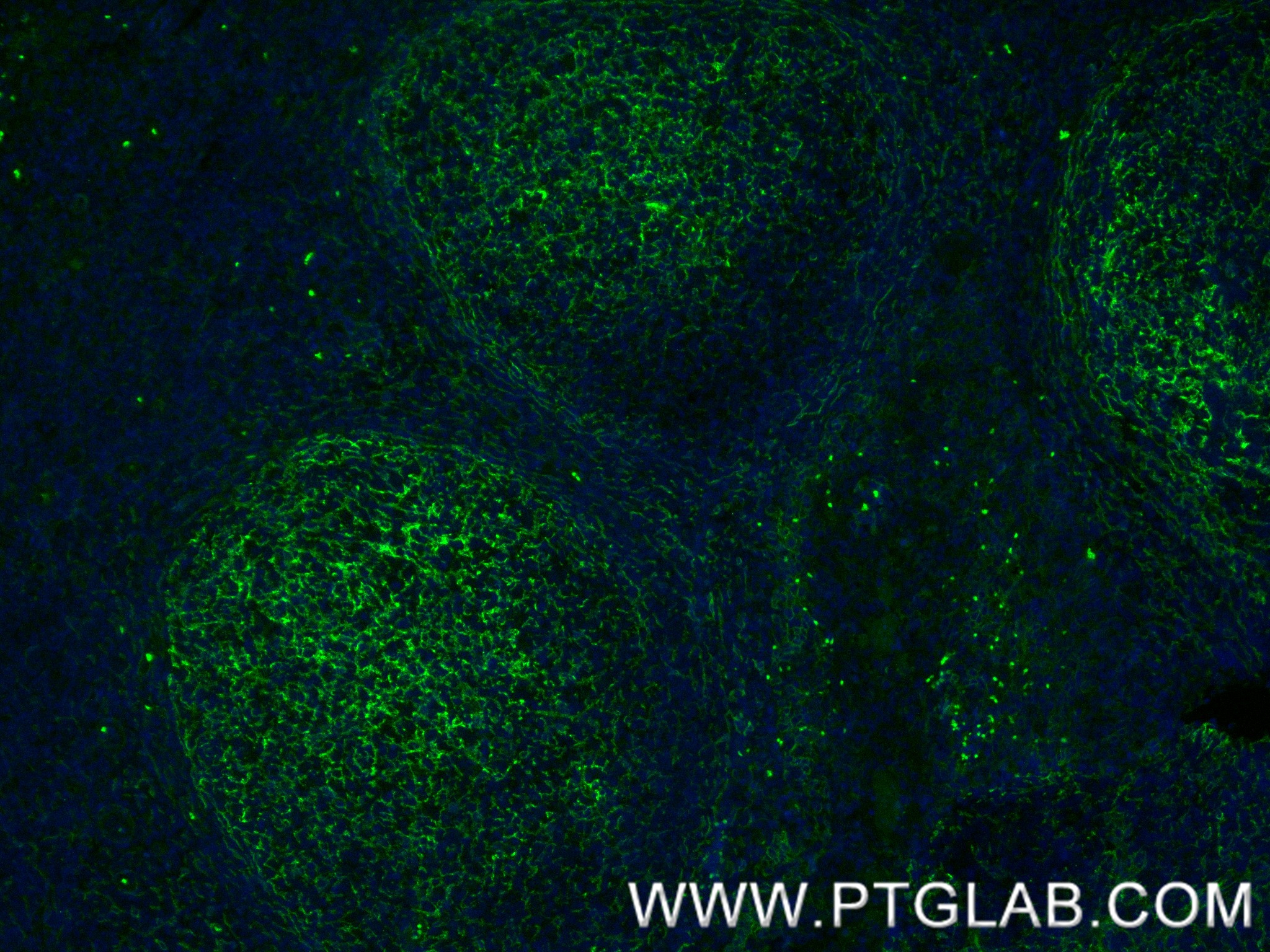 IF Staining of human tonsillitis using 84249-4-RR