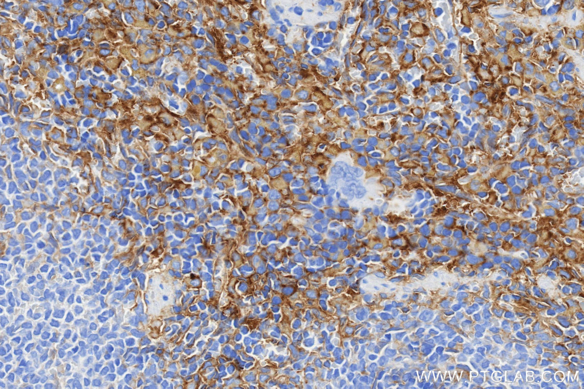 IHC staining of rat spleen using 86797-1-RR