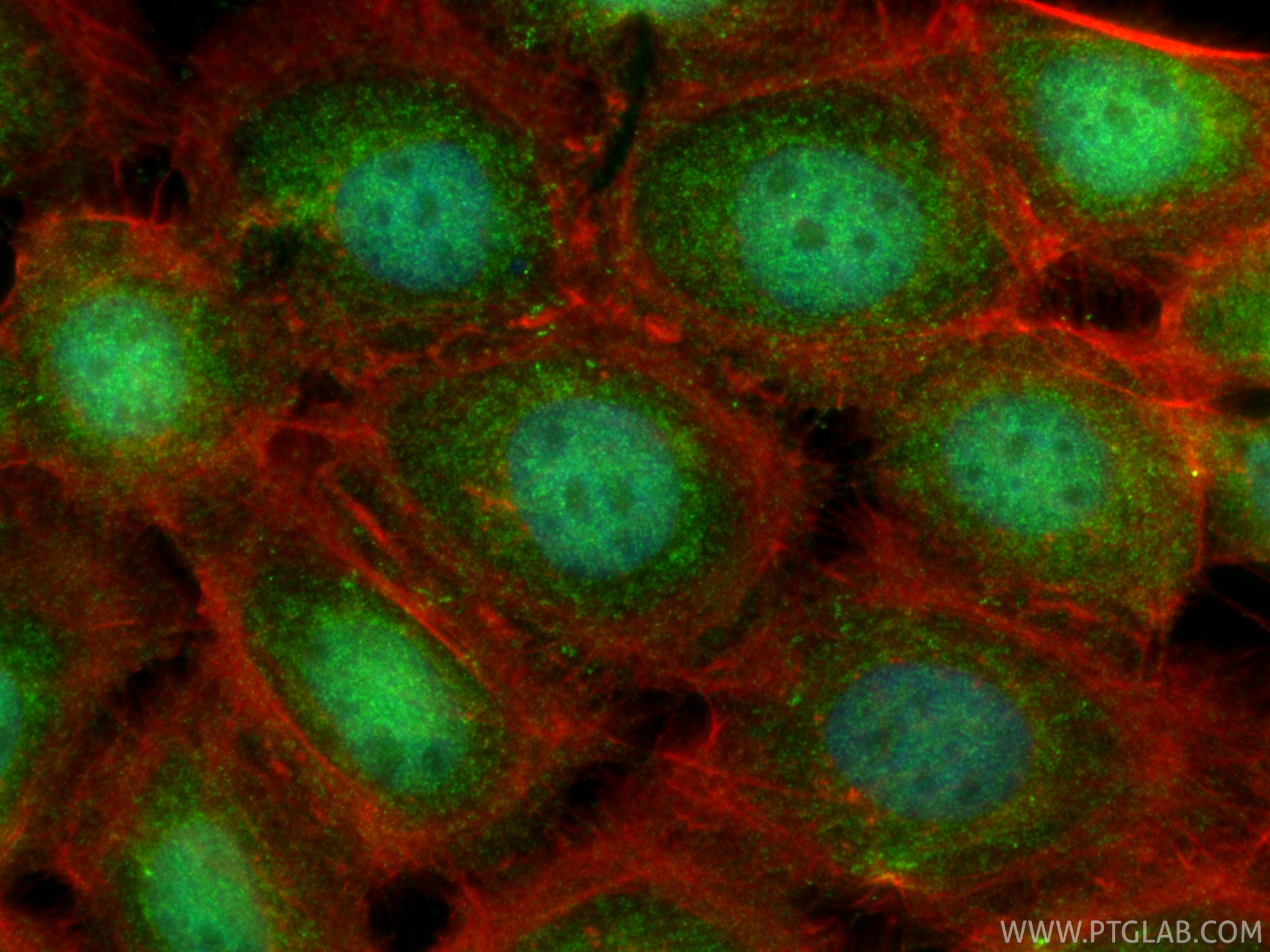 IF Staining of A431 using 10736-1-AP