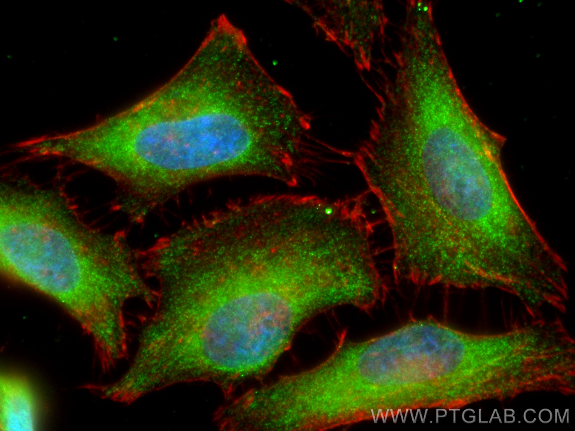 IF Staining of HeLa using 60316-1-Ig