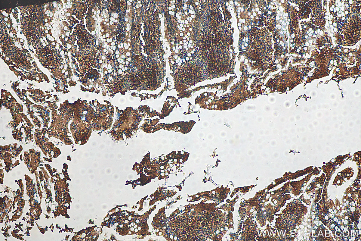 IHC staining of rat small intestine using 82463-1-RR (same clone as 82463-1-PBS)