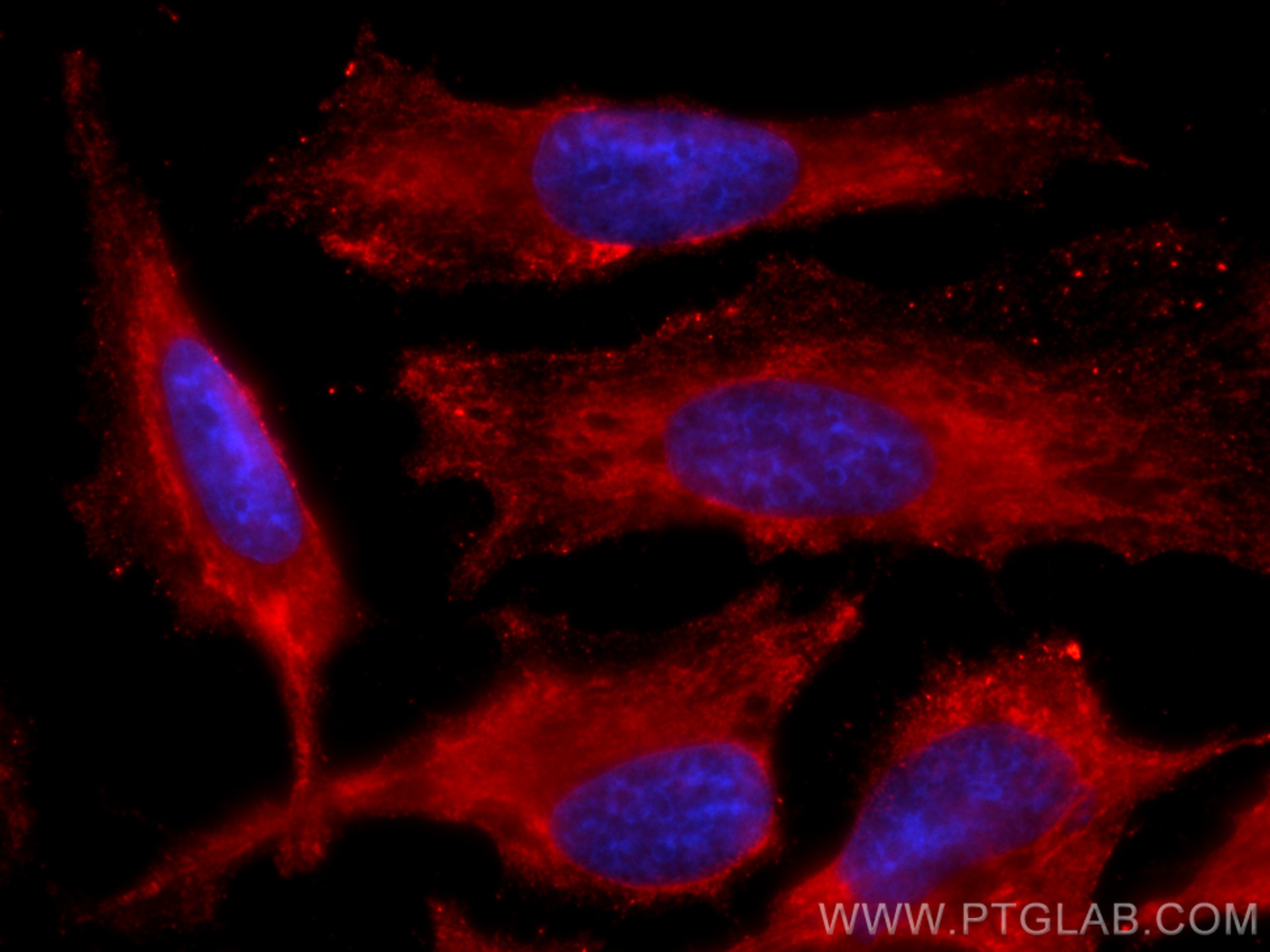 IF Staining of HeLa using CL594-60316