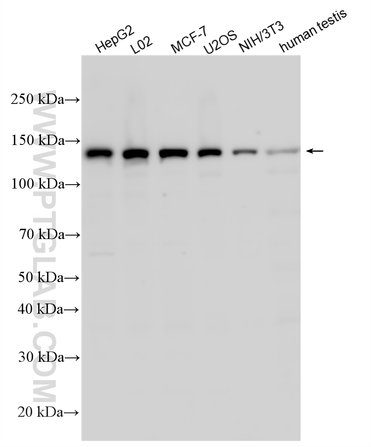 Various lysates were subjected to SDS PAGE followed by western blot with 17802-1-AP (VCPIP1 antibody) at dilution of 1:1000 incubated at room temperature for 1.5 hours. WB analysis using 17802-1-AP