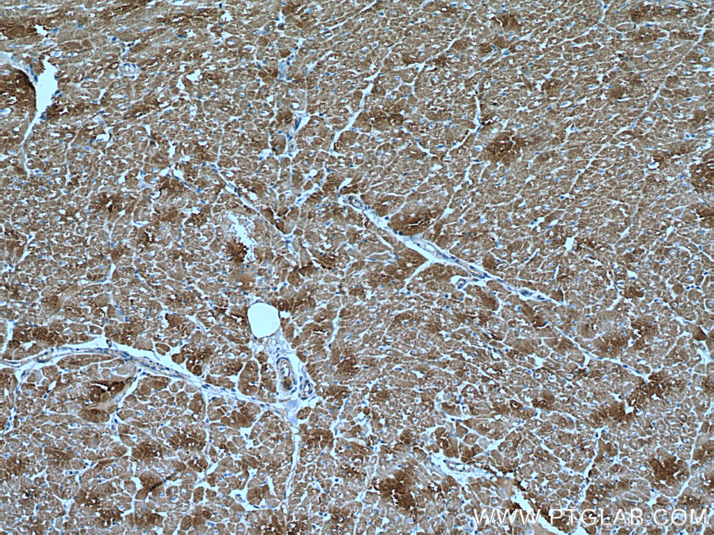 IHC staining of human heart using 55259-1-AP