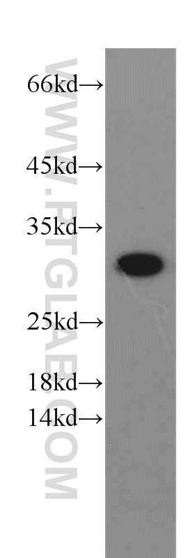 VDAC1/Porin Polyclonal antibody