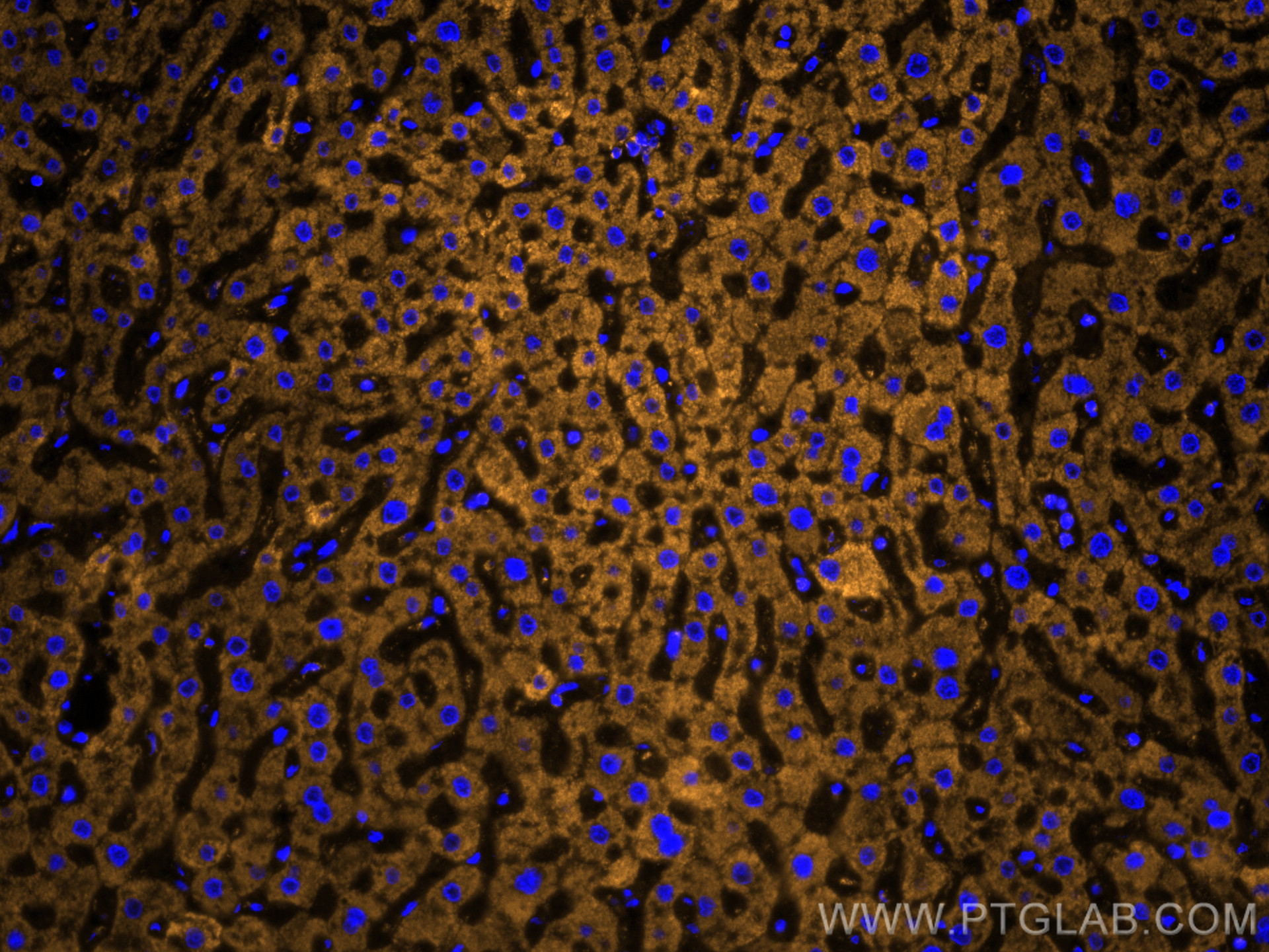 IF Staining of human liver using 81538-1-RR (same clone as 81538-1-PBS)