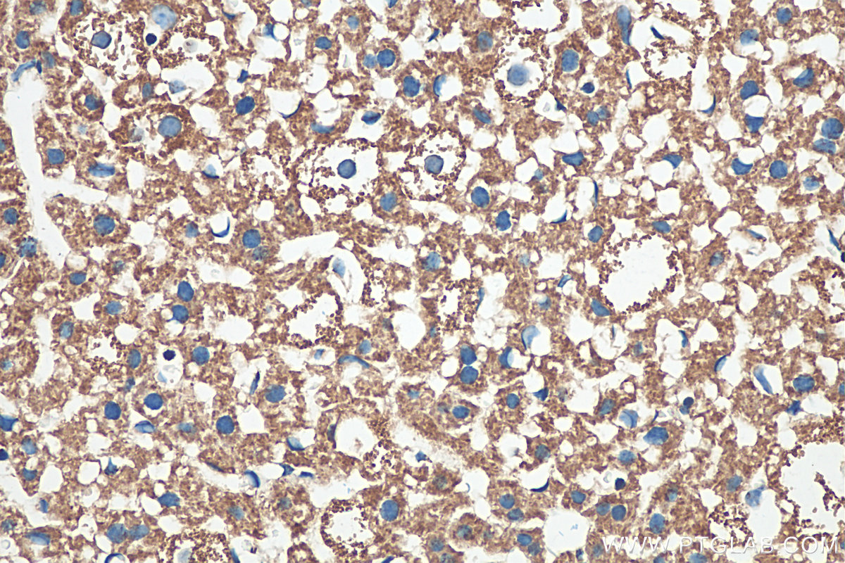 IHC staining of mouse liver using 81538-1-RR (same clone as 81538-1-PBS)