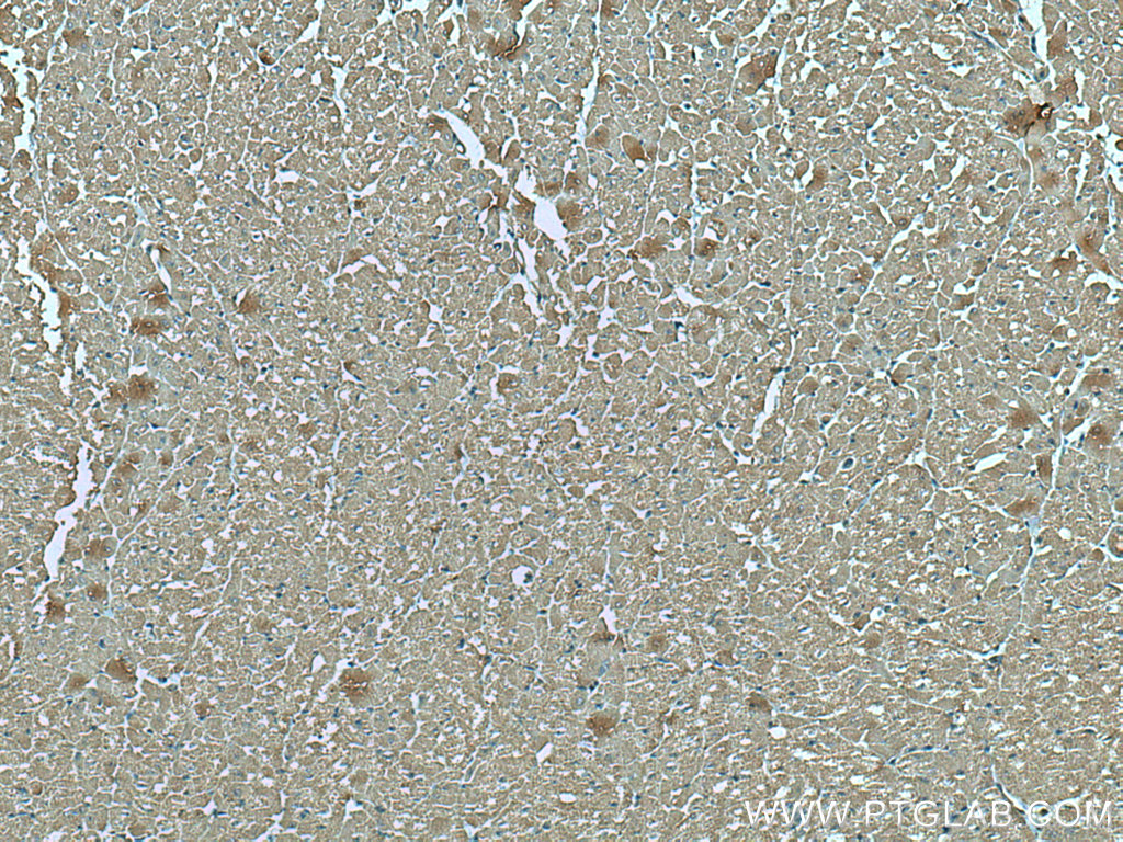 IHC staining of human heart using 66345-1-Ig (same clone as 66345-1-PBS)