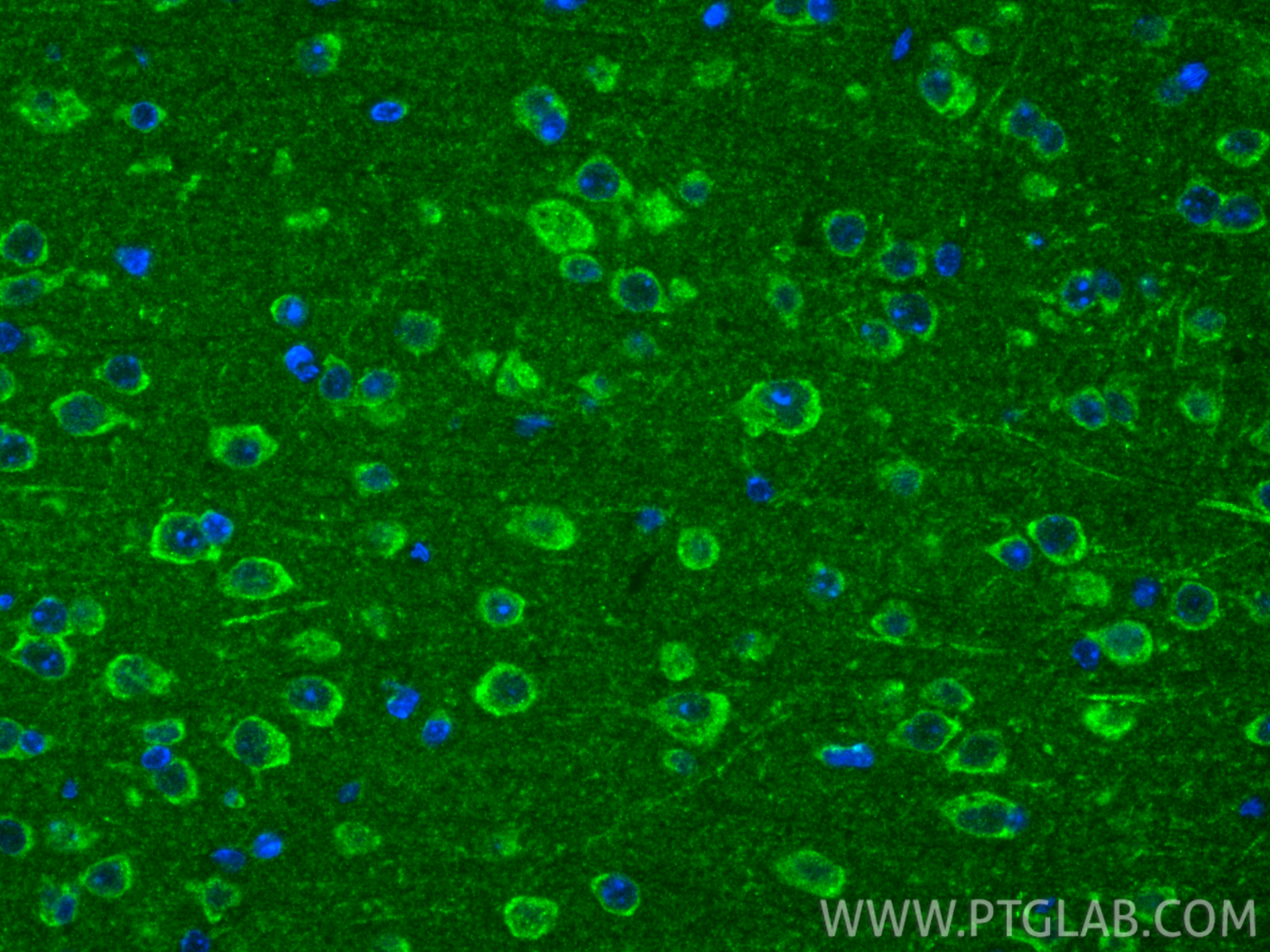 IF Staining of mouse brain using 55261-1-AP