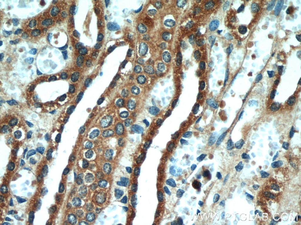 IHC staining of human kidney using 55261-1-AP