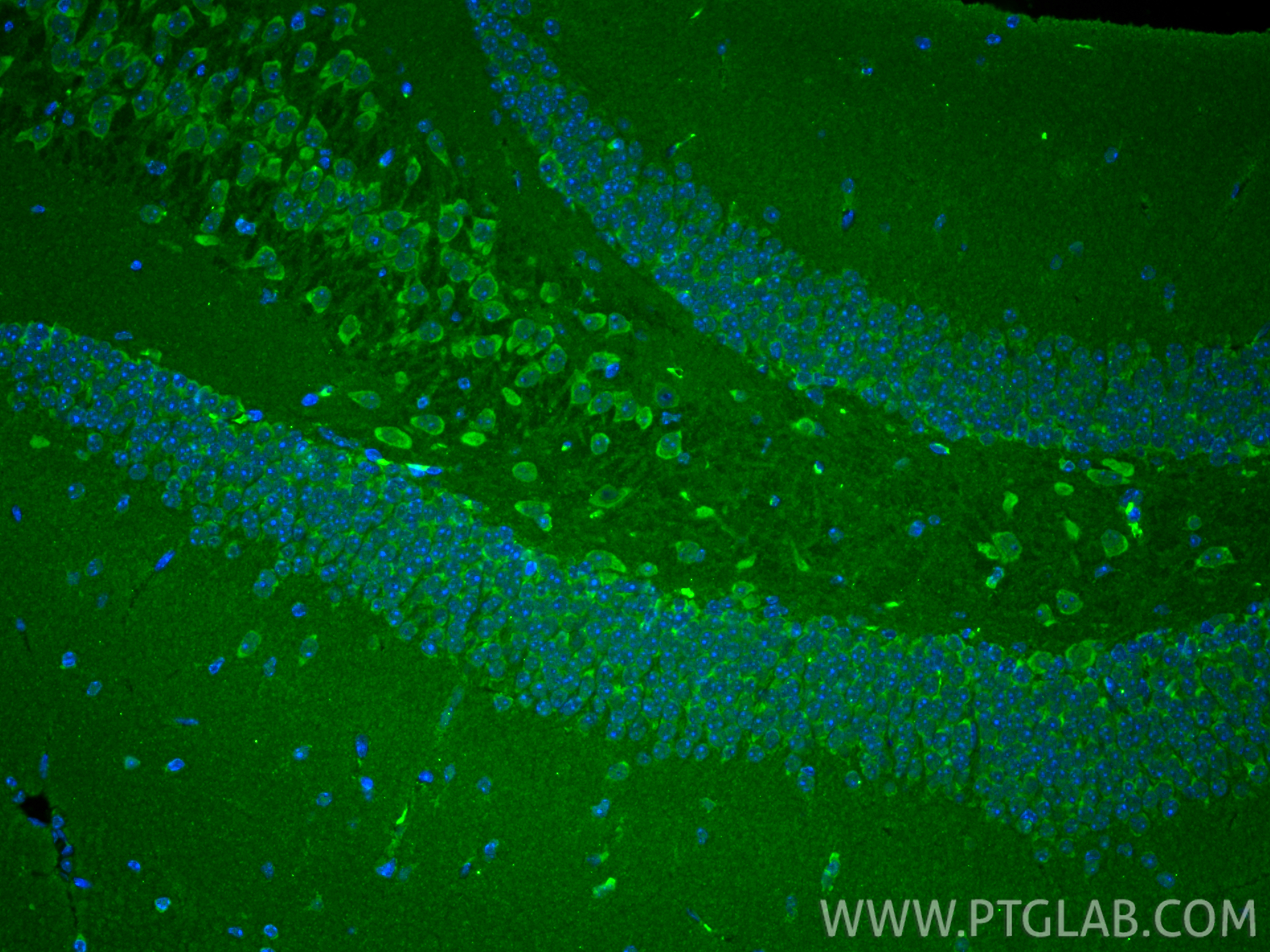 IF Staining of mouse brain using 66388-1-Ig IF Staining of mouse brain using 66388-1-Ig