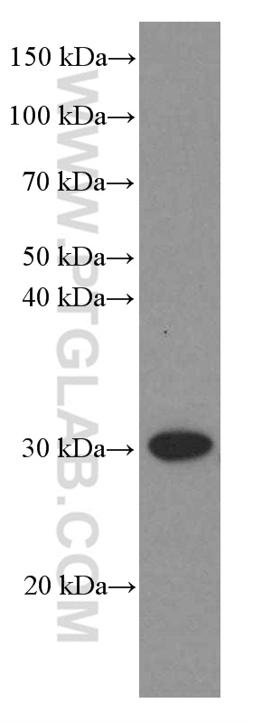 VDAC2 Monoclonal antibody