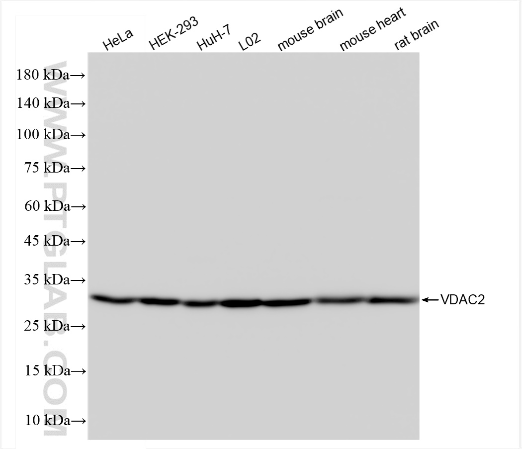 WB analysis using 84225-2-RR (same clone as 84225-2-PBS)