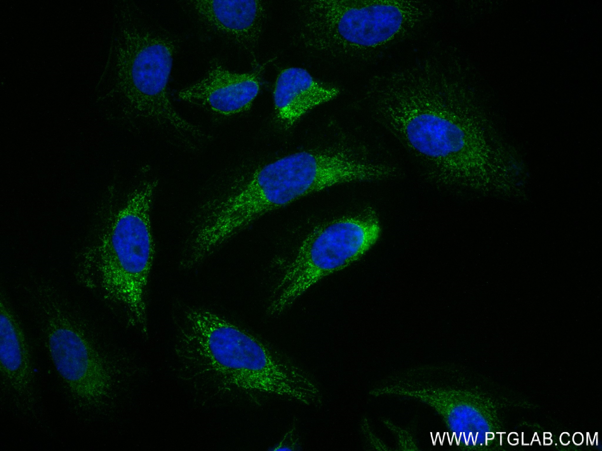 IF Staining of HeLa using 84225-3-RR (same clone as 84225-3-PBS)