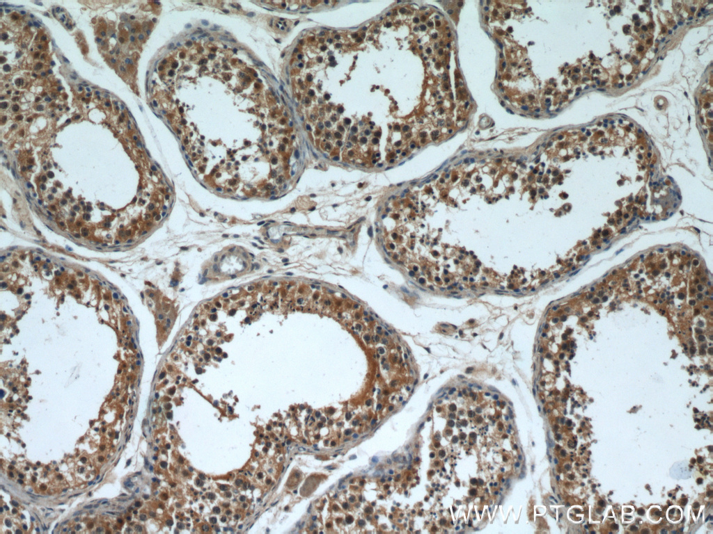 IHC staining of human testis using 55260-1-AP