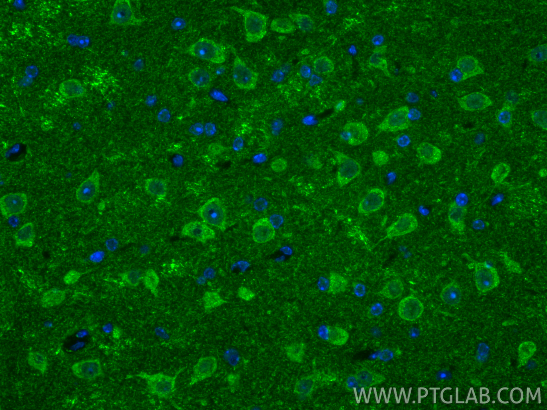 IF Staining of mouse brain using RMX00001