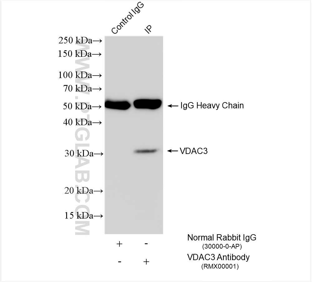 IP experiment of HeLa using RMX00001