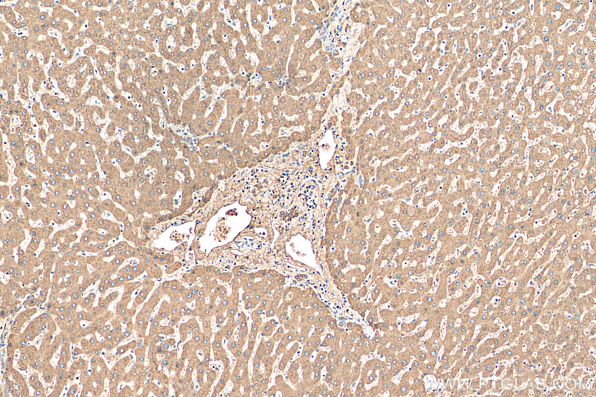 IHC staining of human liver using 16922-1-AP