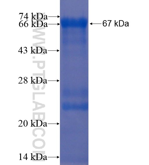 VDBP,GC fusion protein Ag10286 SDS-PAGE