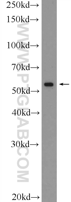 VDR Polyclonal antibody