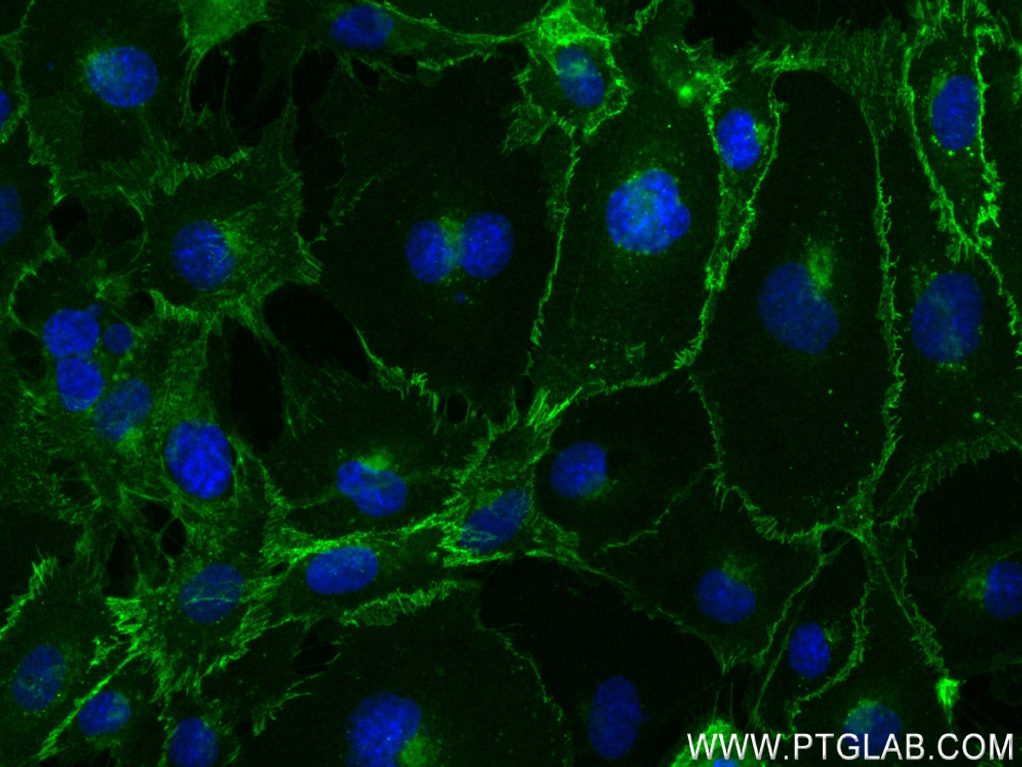 IF Staining of HUVEC using 83766-2-RR (same clone as 83766-2-PBS)