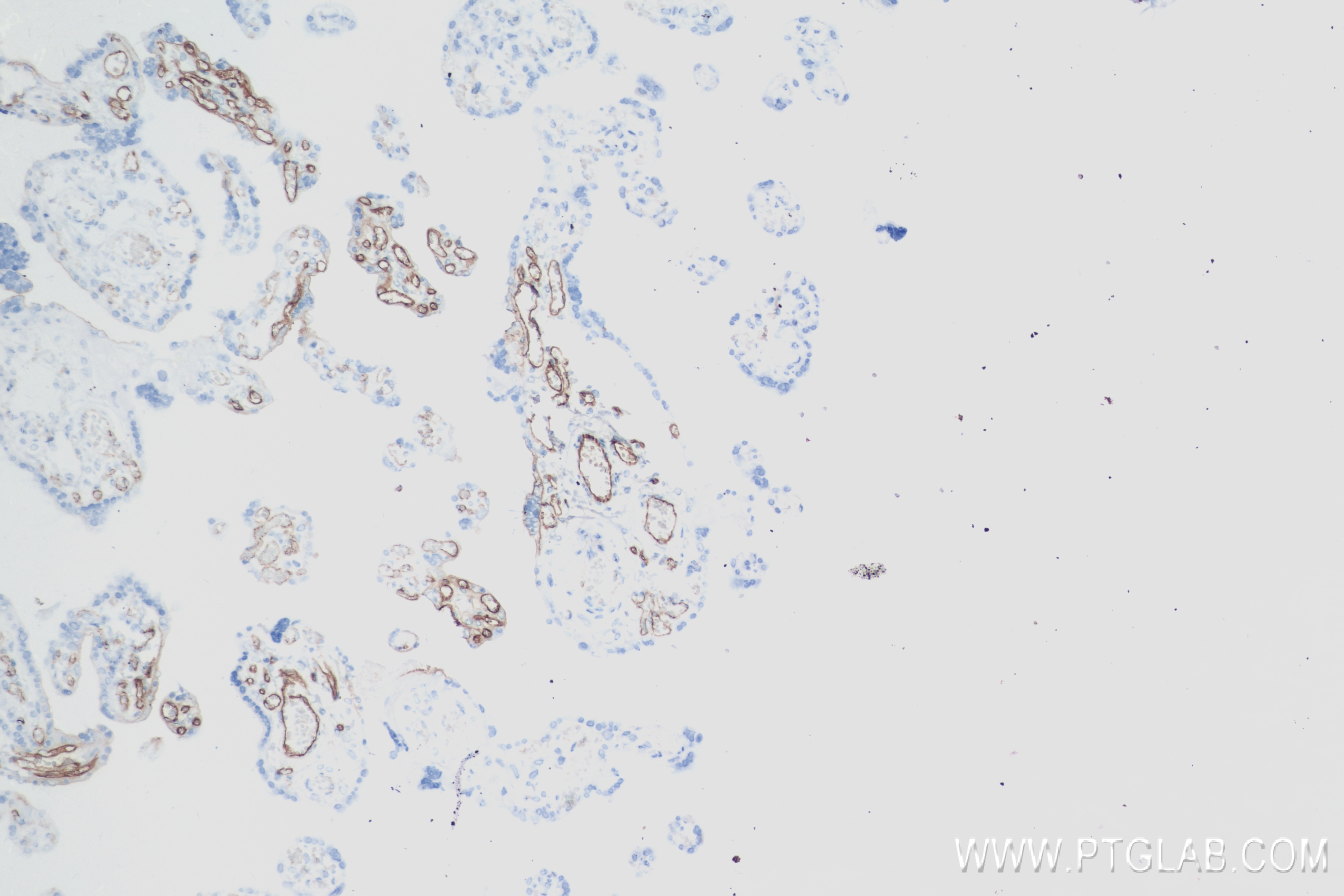 IHC staining of human placenta using 83766-2-RR (same clone as 83766-2-PBS)