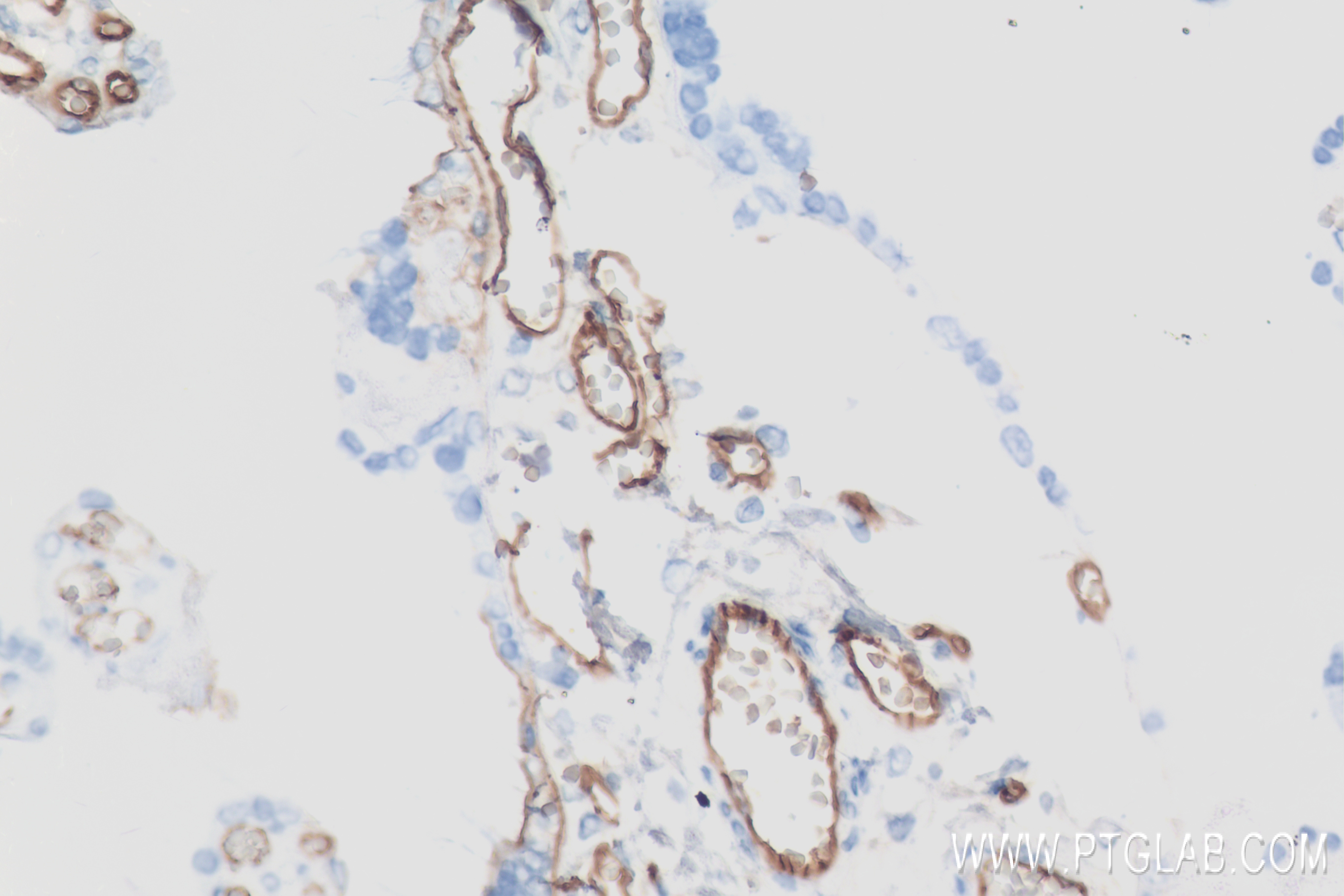 IHC staining of human placenta using 83766-2-RR (same clone as 83766-2-PBS)