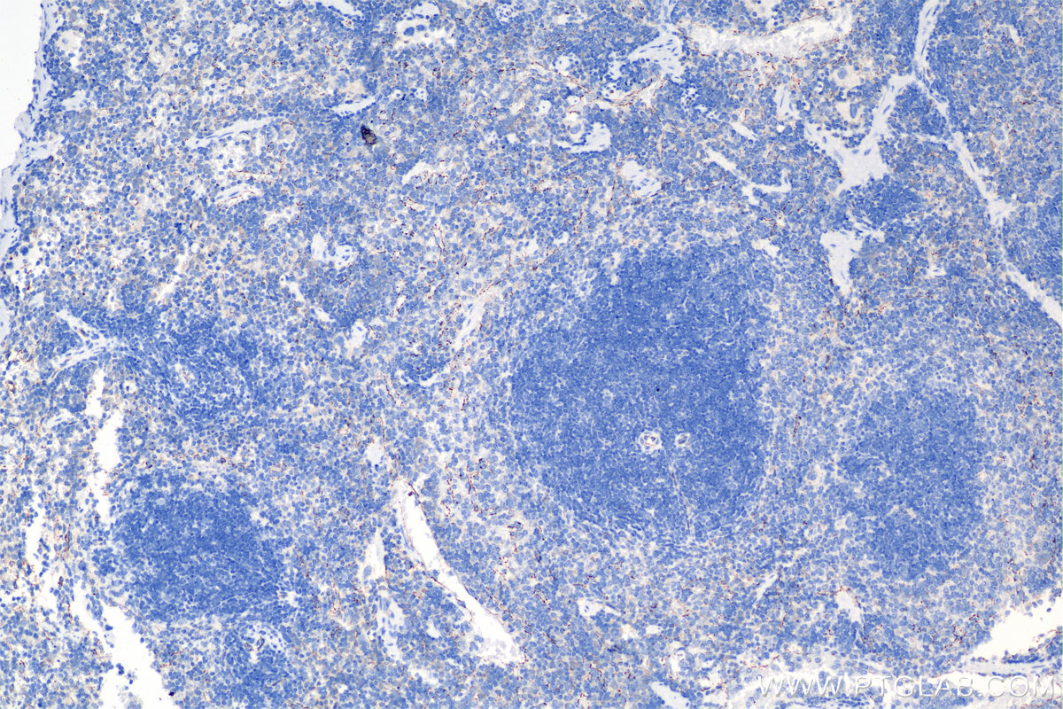 IHC staining of mouse spleen using 84529-3-RR