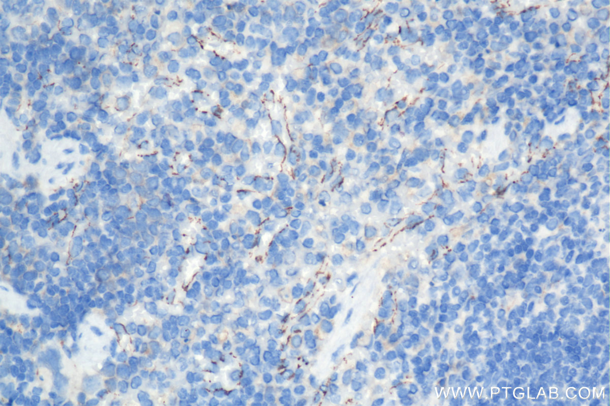 IHC staining of mouse spleen using 84529-3-RR