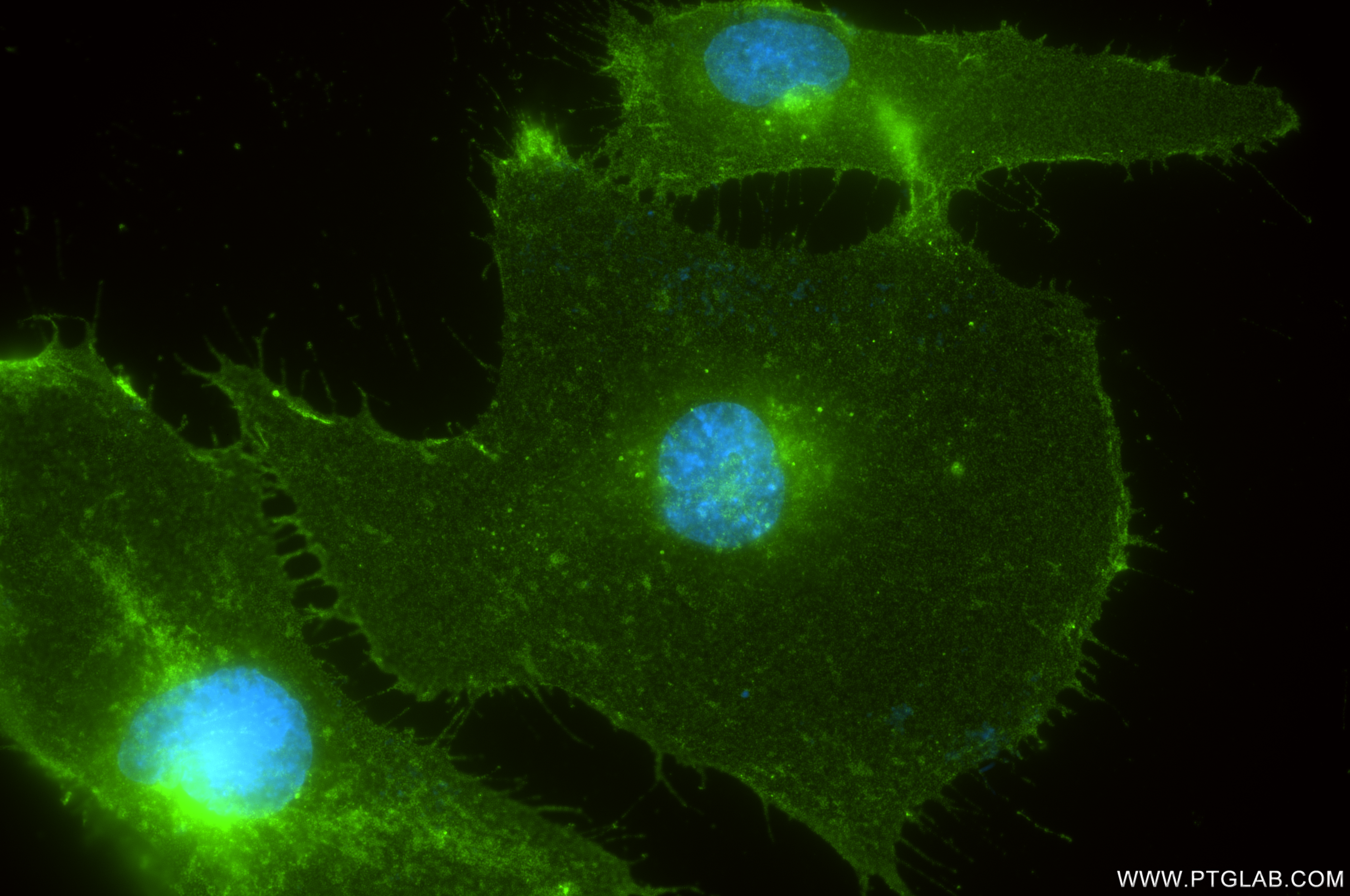 IF Staining of HUVEC using 83766-6-RR