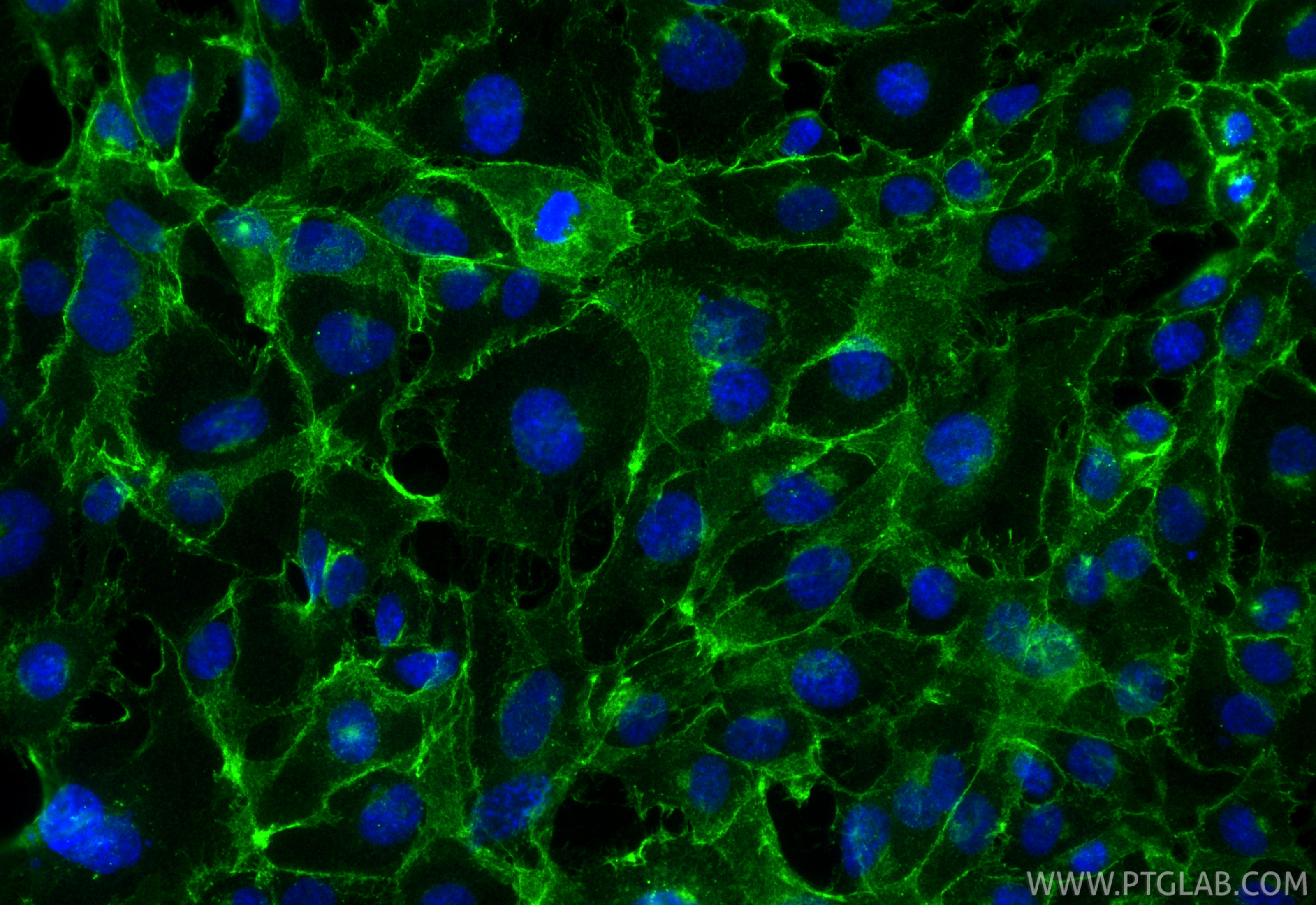 Immunofluorescent analysis of (4% PFA) fixed HUVEC cells using VE-cadherin/CD144 antibody (<a class='green' href='/productredirect?CatalogNo=83766-6-RR' target='_blank'>83766-6-RR</a>, Clone: 240755D5 ) at dilution of 1:500 and CoraLite®488-Conjugated Goat Anti-Rabbit IgG(H+L) (<a class='green' href='/productredirect?CatalogNo=SA00013-2' target='_blank'>SA00013-2</a>). This data was developed using the same antibody clone with 83766-6-PBS in a different storage buffer formulation. IF Staining of HUVEC using 83766-6-RR (same clone as 83766-6-PBS)