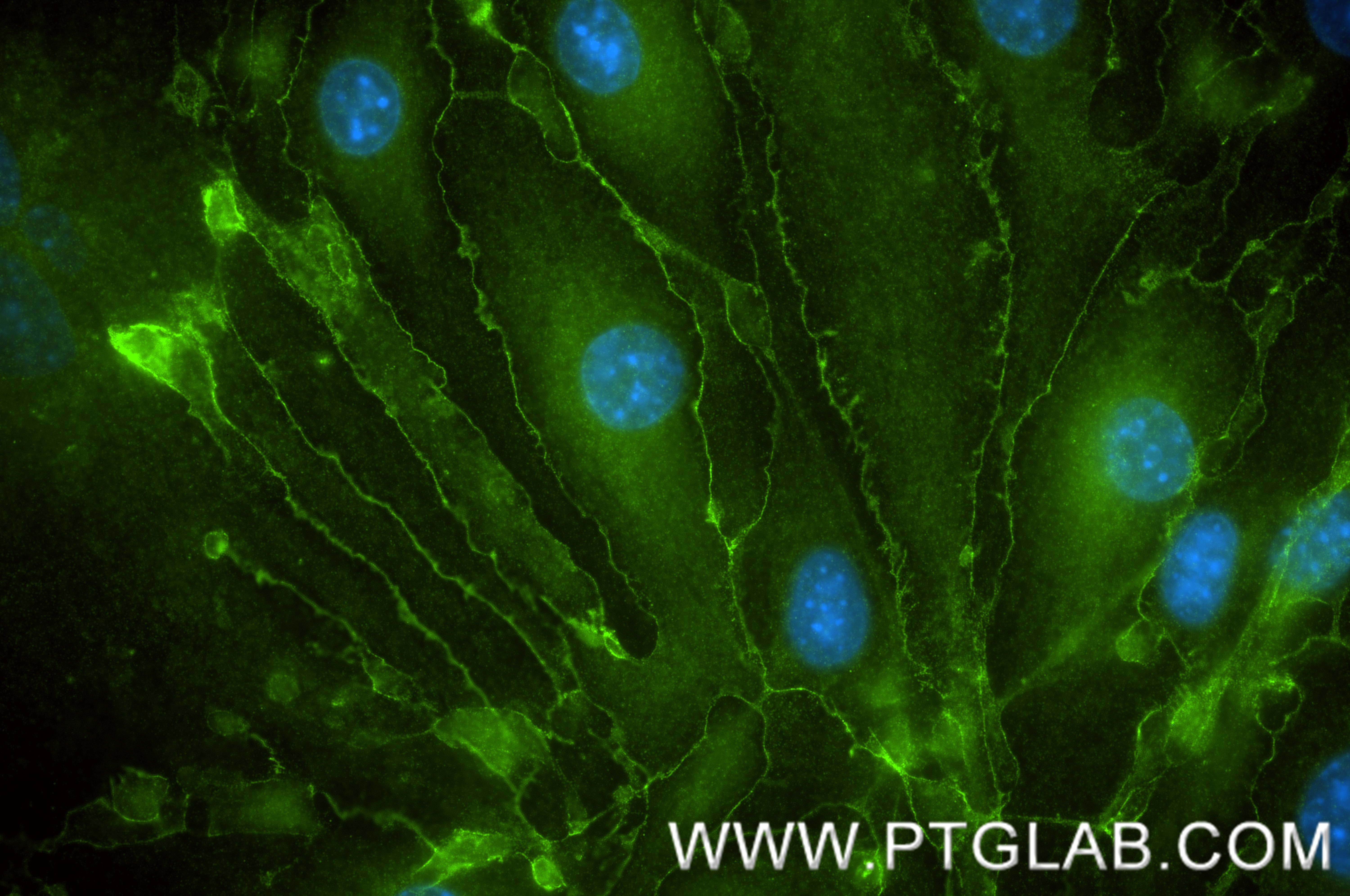 IF Staining of bEnd.3 using 84529-4-RR