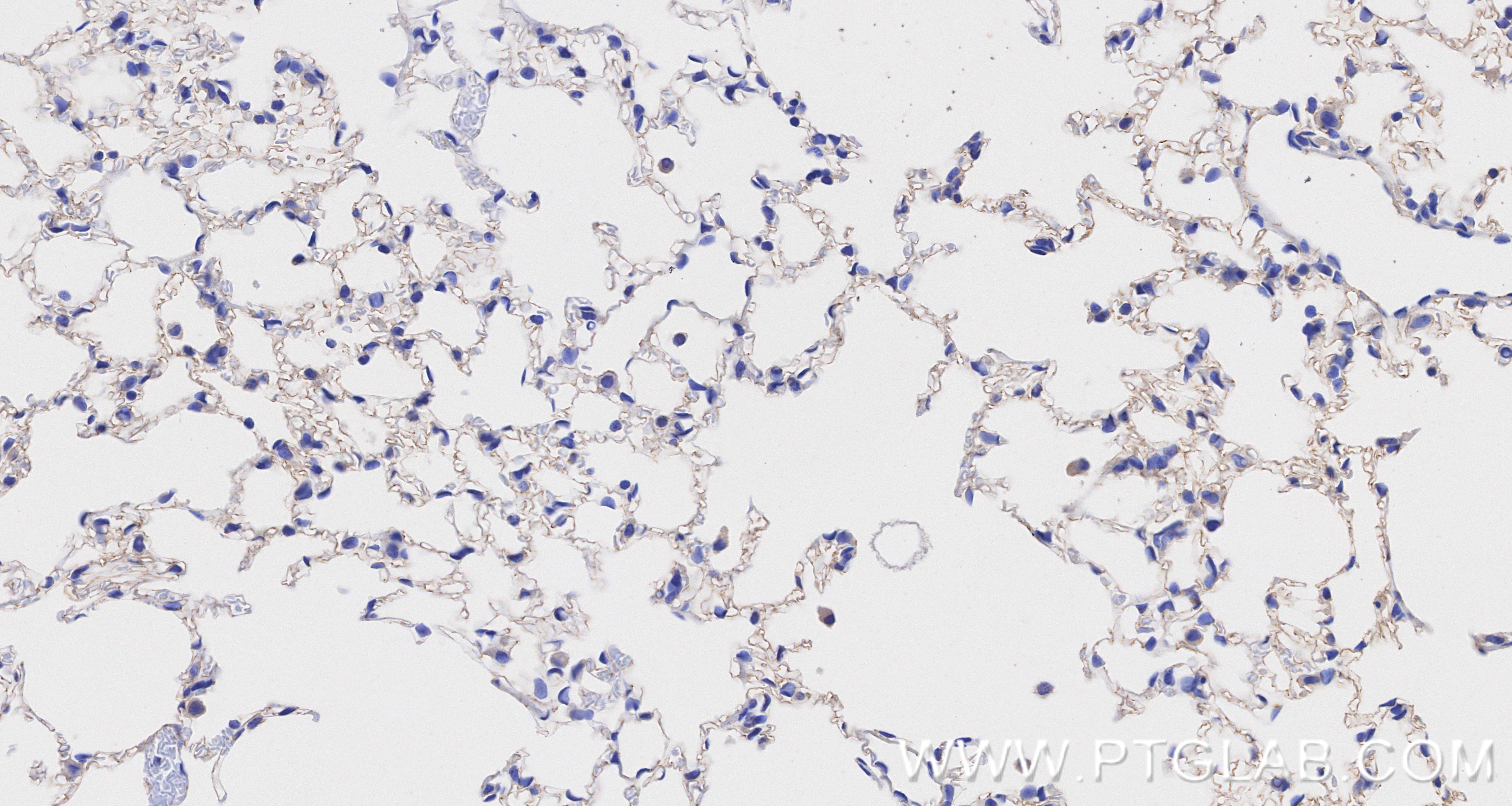 IHC staining of mouse lung using 84529-4-RR IHC staining of mouse lung using 84529-4-RR