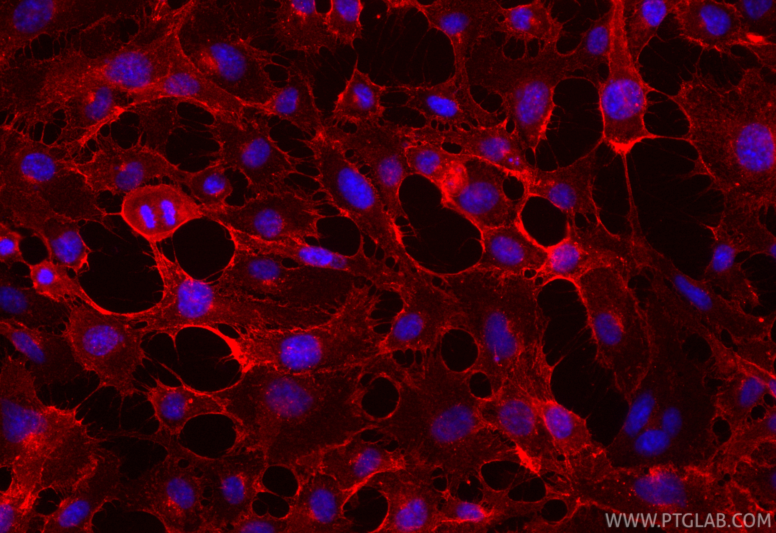 IF Staining of HUVEC using CL594-83766-6