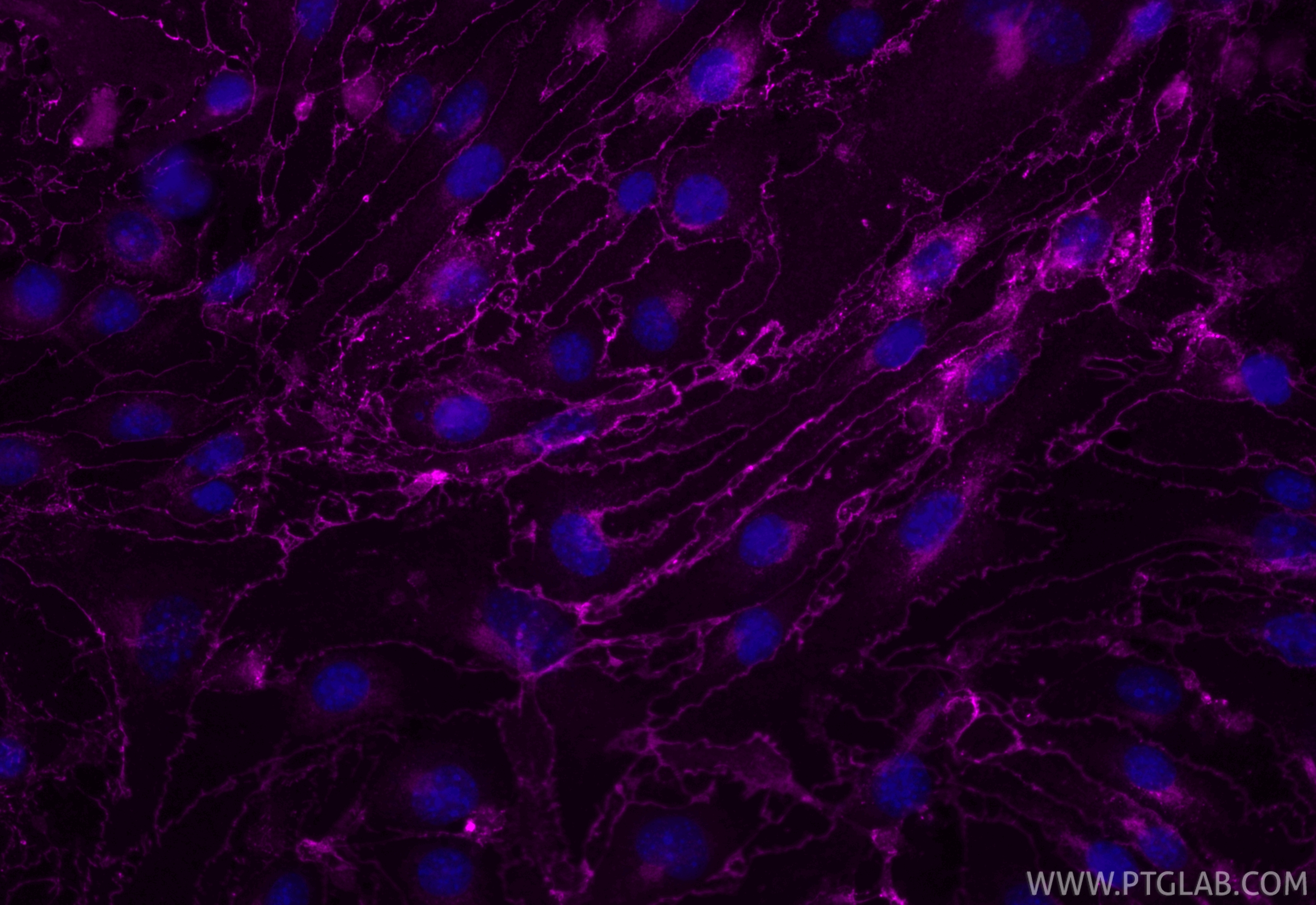 IF Staining of bEnd.3 using CL647-84529-3