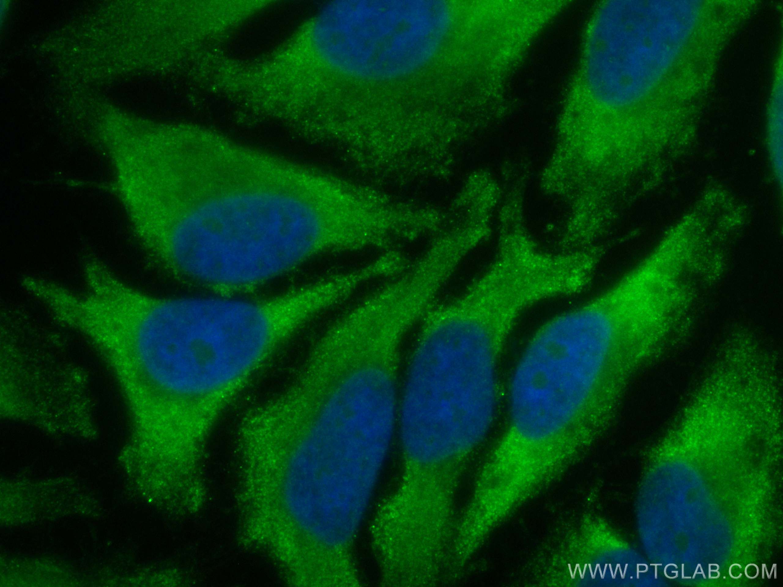 IF Staining of HeLa using CL488-19003