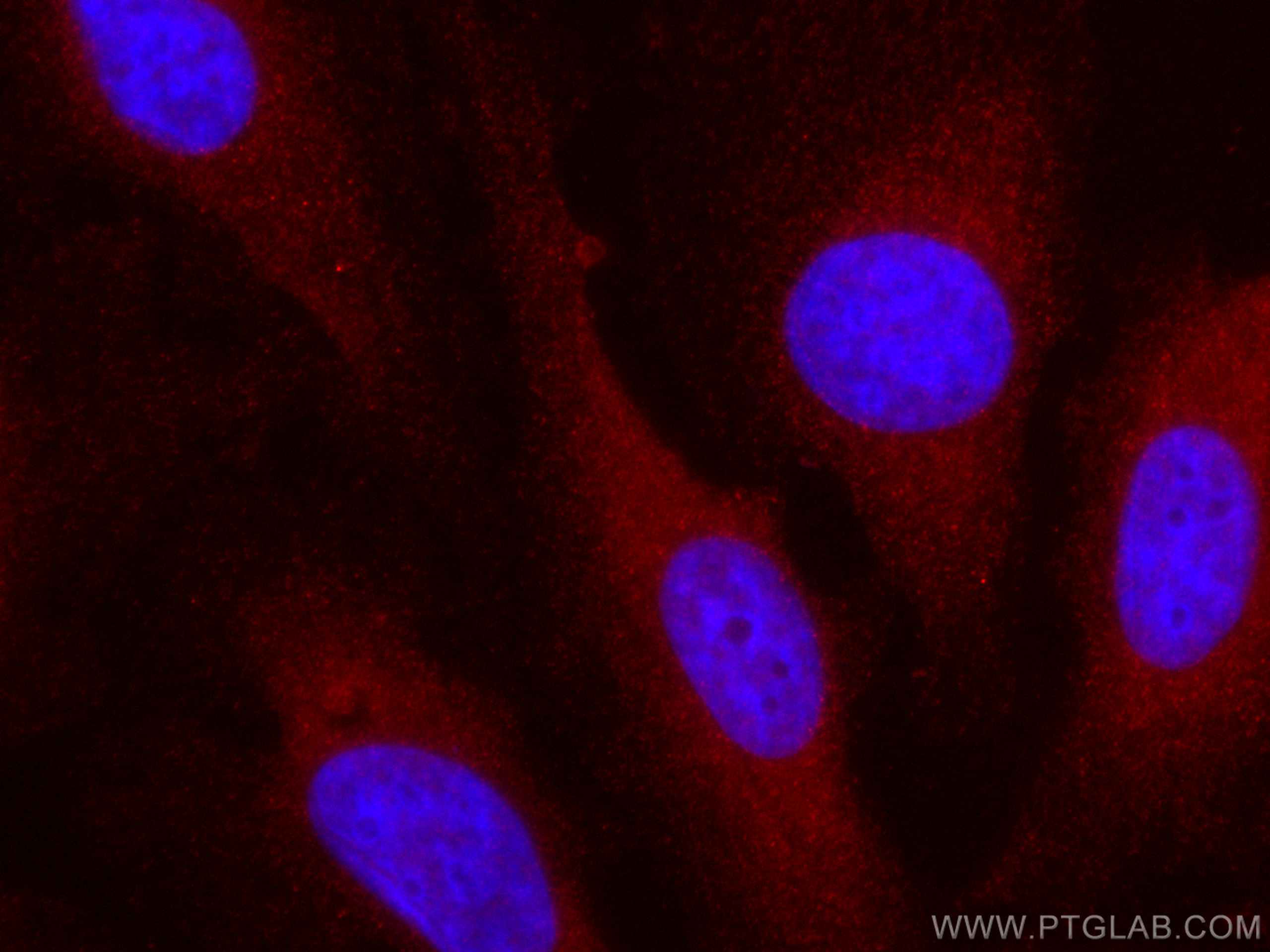 IF Staining of HeLa using CL594-19003