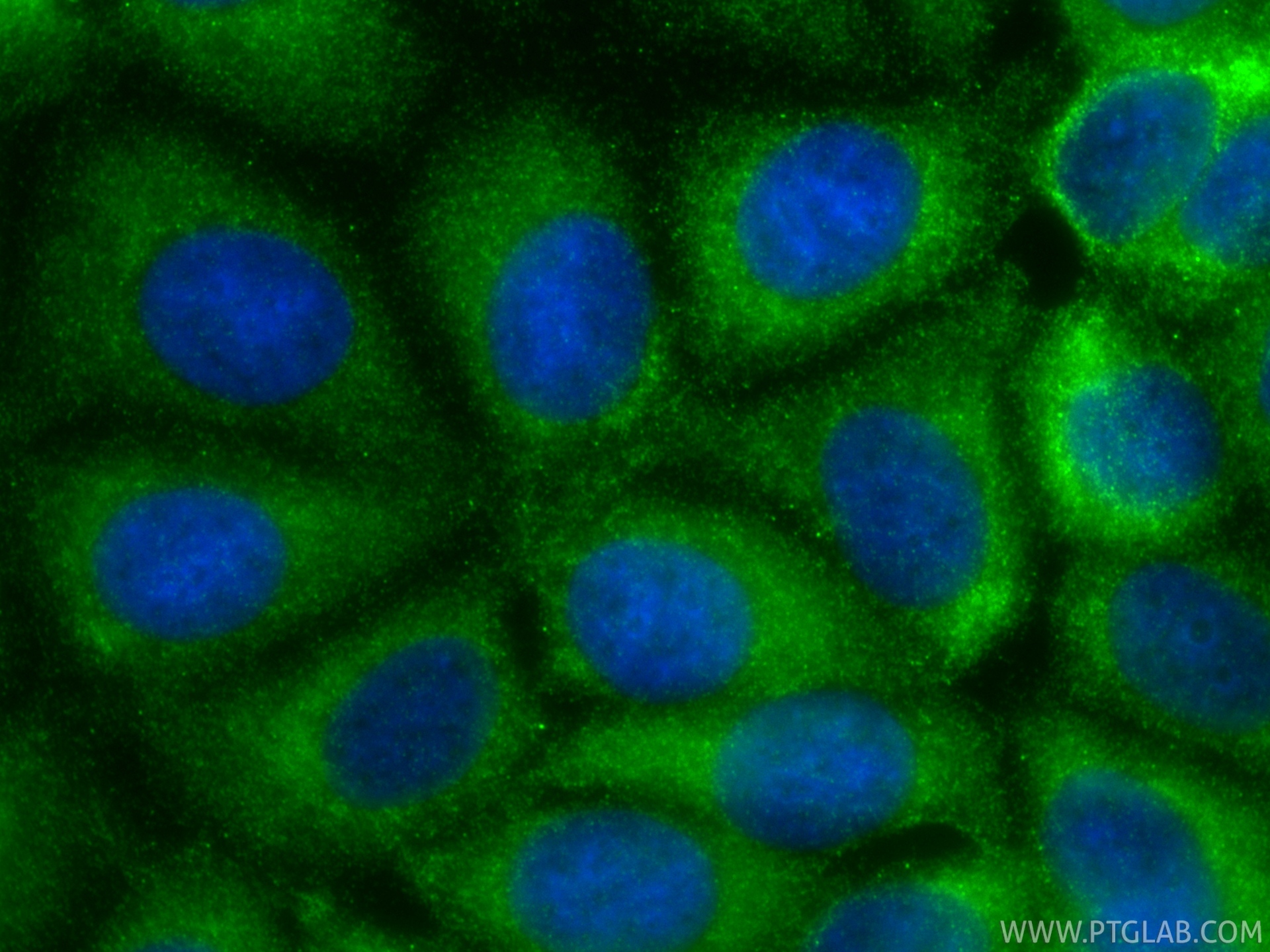 IF Staining of MCF-7 using 83727-7-RR