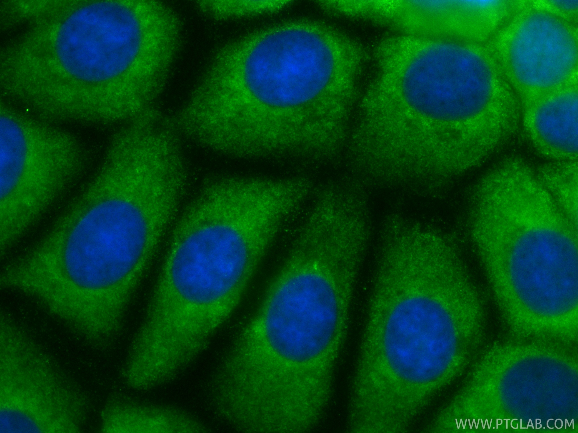 IF Staining of MCF-7 using CL488-83727-7 IF Staining of MCF-7 using CL488-83727-7