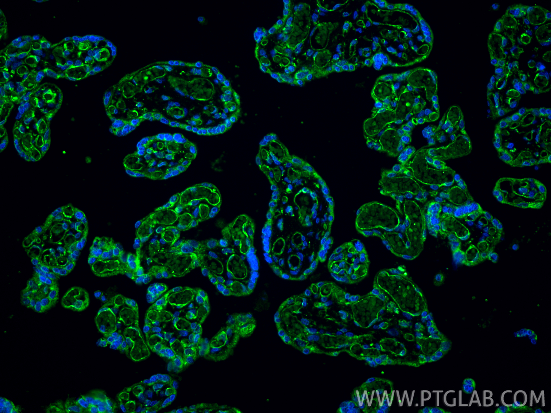 IF Staining of human placenta using 83049-4-RR