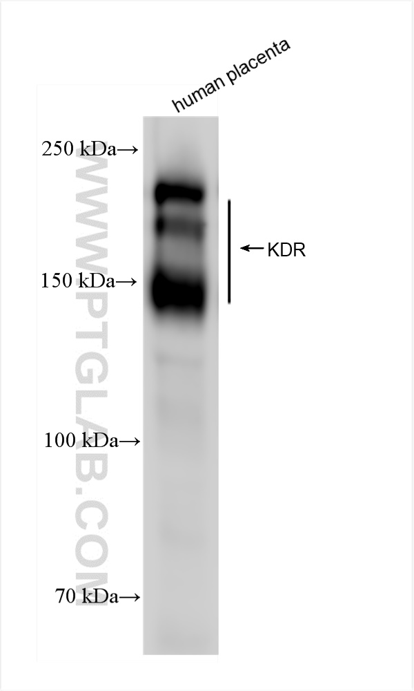 WB analysis of human placenta using 83049-4-RR (same clone as 83049-4-PBS)