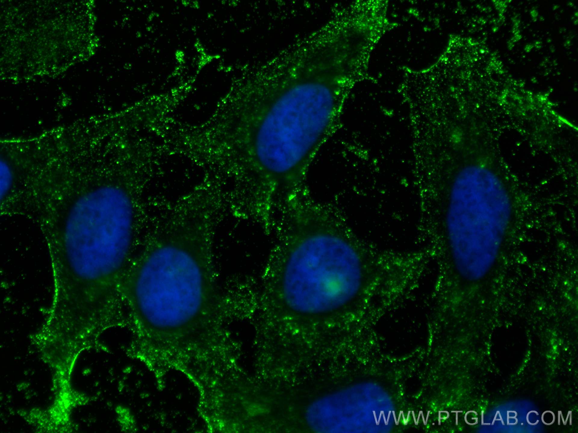 IF Staining of HeLa using 19003-1-AP