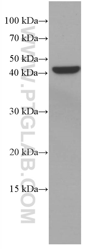 WB analysis of MCF-7 using 66828-1-Ig