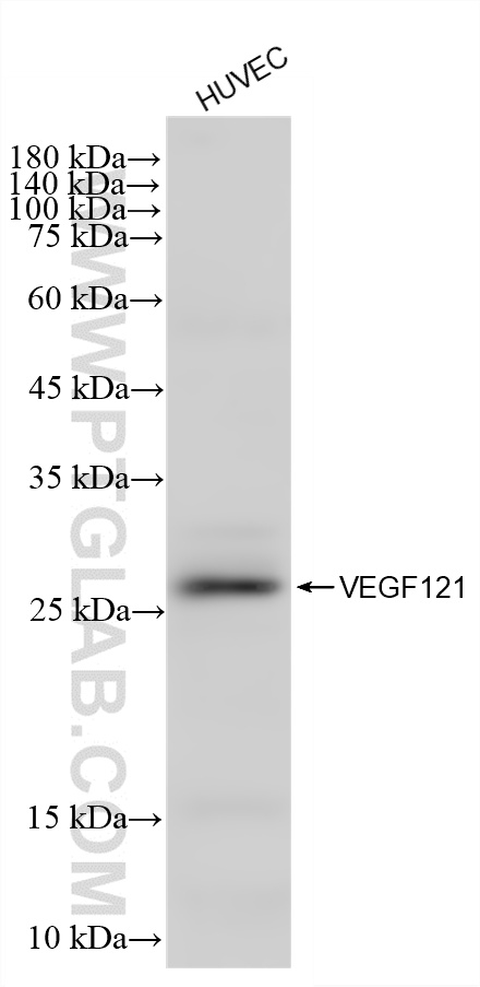 WB analysis of HUVEC using 87404-1-RR WB analysis of HUVEC using 87404-1-RR