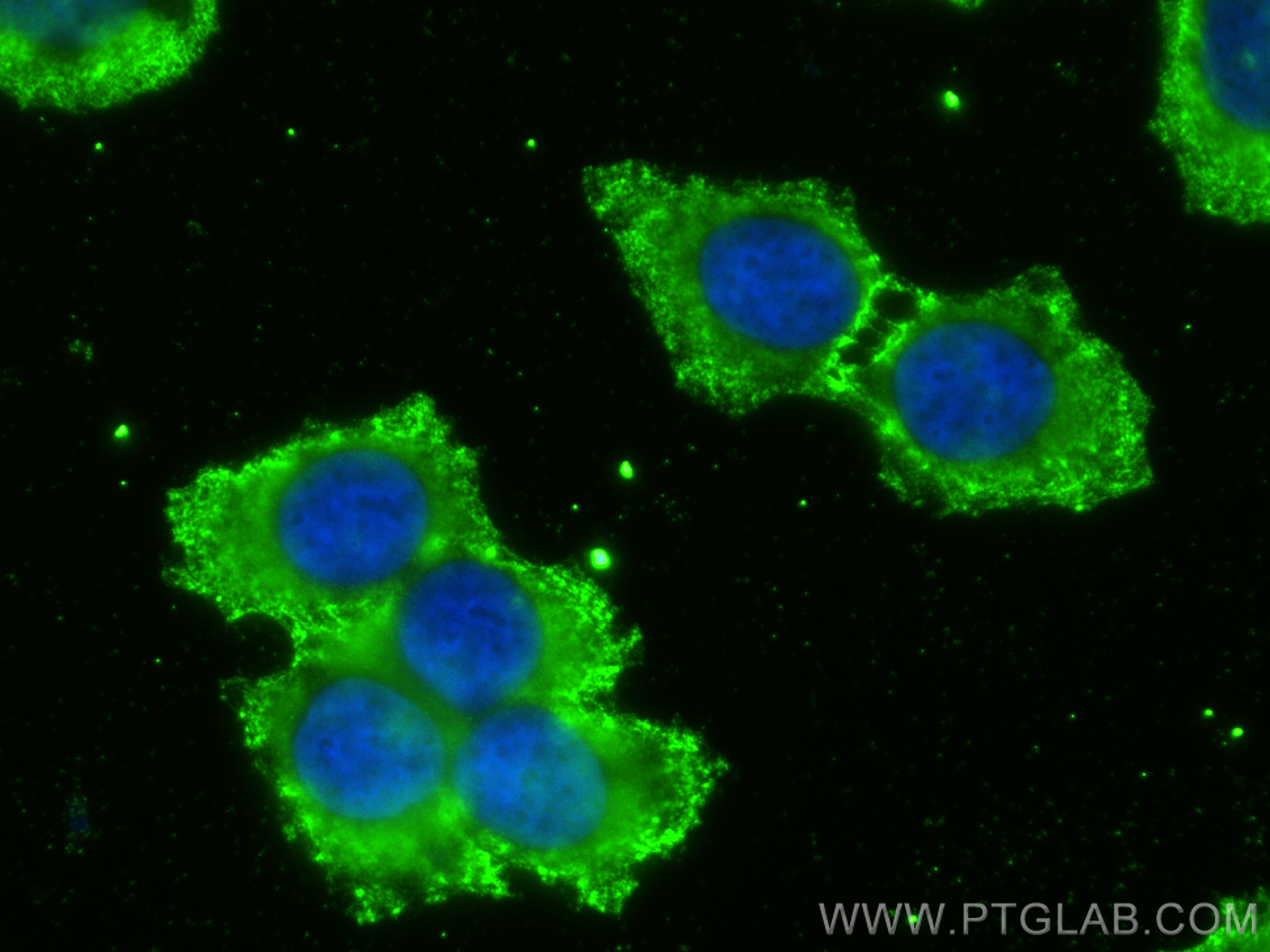 IF Staining of MCF-7 using 67116-1-Ig